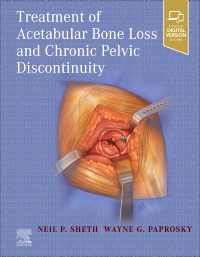 cover image - Treatment of Acetabular Bone Loss and Chronic Pelvic Discontinuity,1st Edition