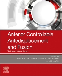 cover image - Anterior Controllable Antedisplacement and Fusion,1st Edition
