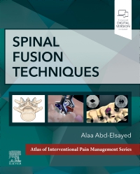 cover image - Spinal Fusion Techniques,1st Edition