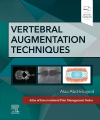 cover image - Vertebral Augmentation Techniques,1st Edition