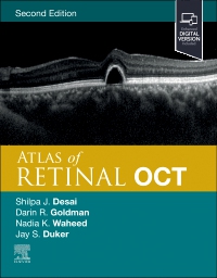 cover image - Atlas of Retinal OCT,2nd Edition