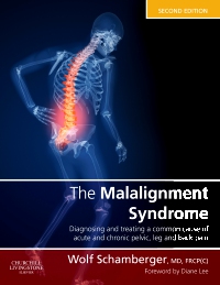 cover image - The Malalignment Syndrome,2nd Edition