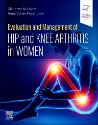 cover image - Evaluation and Management of Hip and Knee Arthritis in Women, 1st Edition