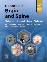 cover image - ExpertDDx: Brain and Spine,3rd Edition
