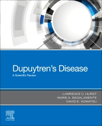 cover image - Dupuytren's Disease,1st Edition