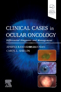 cover image - Clinical Cases in Ocular Oncology,1st Edition