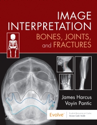 cover image - Evolve Resources for Image Interpretation: Bones, Joints, and Fractures,1st Edition
