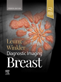 Diagnostic Imaging: Breast, 4th Edition - 9780443284472