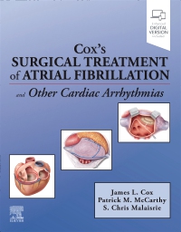 cover image - Cox’s Surgical Treatment of Atrial Fibrillation, 1st Edition