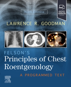 cover image - Felson's Principles of Chest Roentgenology: - Elsevier E-Book on VitalSource, 6th Edition