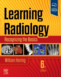 cover image - Learning Radiology - Elsevier E-Book on VitalSource, 6th Edition