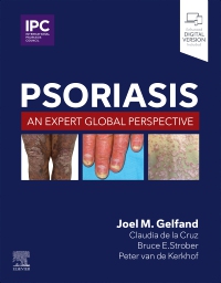 cover image - Psoriasis, 1st Edition
