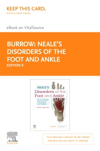 cover image - Neale's Disorders of the Foot and Ankle- Elsevier eBook on VitalSource (Retail Access Card),9th Edition