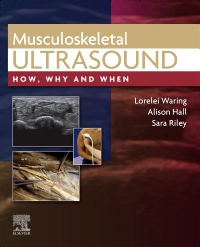 cover image - Musculoskeletal Ultrasound, Elsevier E-Book on VitalSource,1st Edition