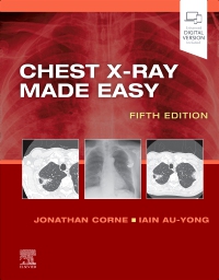 cover image - Chest X-Ray Made Easy,5th Edition