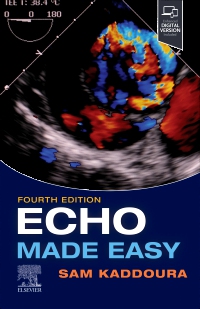 cover image - Echo Made Easy,4th Edition