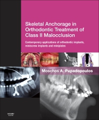 cover image - Skeletal Anchorage in Orthodontic Treatment of Class II Malocclusion - Elsevier eBook on VitalSource,1st Edition