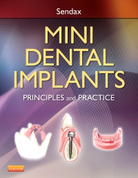 cover image - Mini Dental Implants,1st Edition