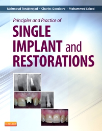 cover image - Principles and Practice of Single Implant and Restoration,1st Edition