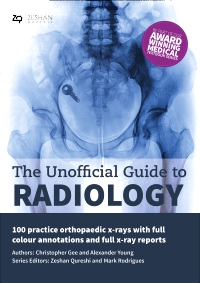 cover image - The Unofficial Guide to Radiology: 100 Practice Orthopaedic X Rays with Full Colour Annotations and Full X Ray Reports,2nd Edition