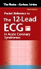 Pocket Reference for the 12-Lead ECG in Acute Coronary Syndromes - Elsevier eBook on VitalSource, 3rd Edition
