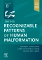 Smith's Recognizable Patterns of Human Malformation, 8th
