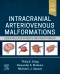 Intracranial Arteriovenous Malformations