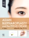 Asian Blepharoplasty and the Eyelid Crease, 4th