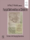 Facial Deformities in Children, 1st Edition