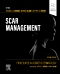 Procedures in Cosmetic Dermatology: Scar Management, 2nd Edition