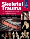 Skeletal Trauma, 1st Edition