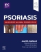 Psoriasis, 1st Edition